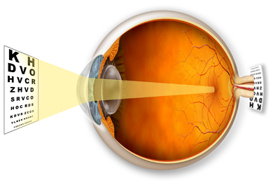Hypermetropia Guide from Blink Opticians